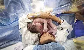 HEALTH-अस्पतालों में बिना जरूरत के बढ़ते सिजेरियन